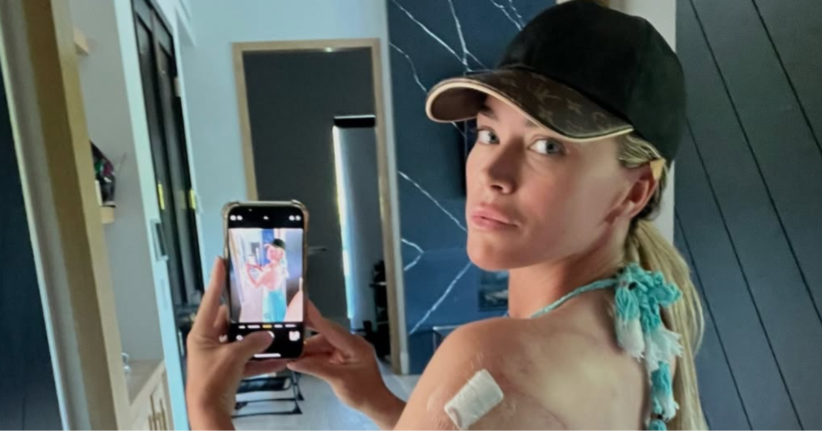 Teddi Mellencamp radiation