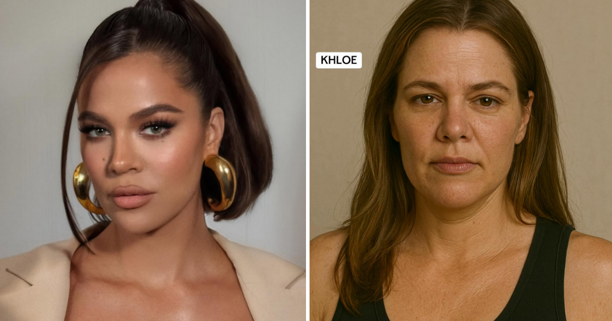 plastic surgery Kardashians