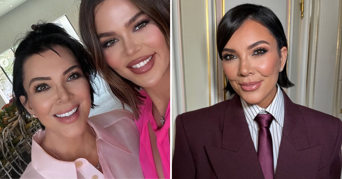 kris jenner plastic surgery