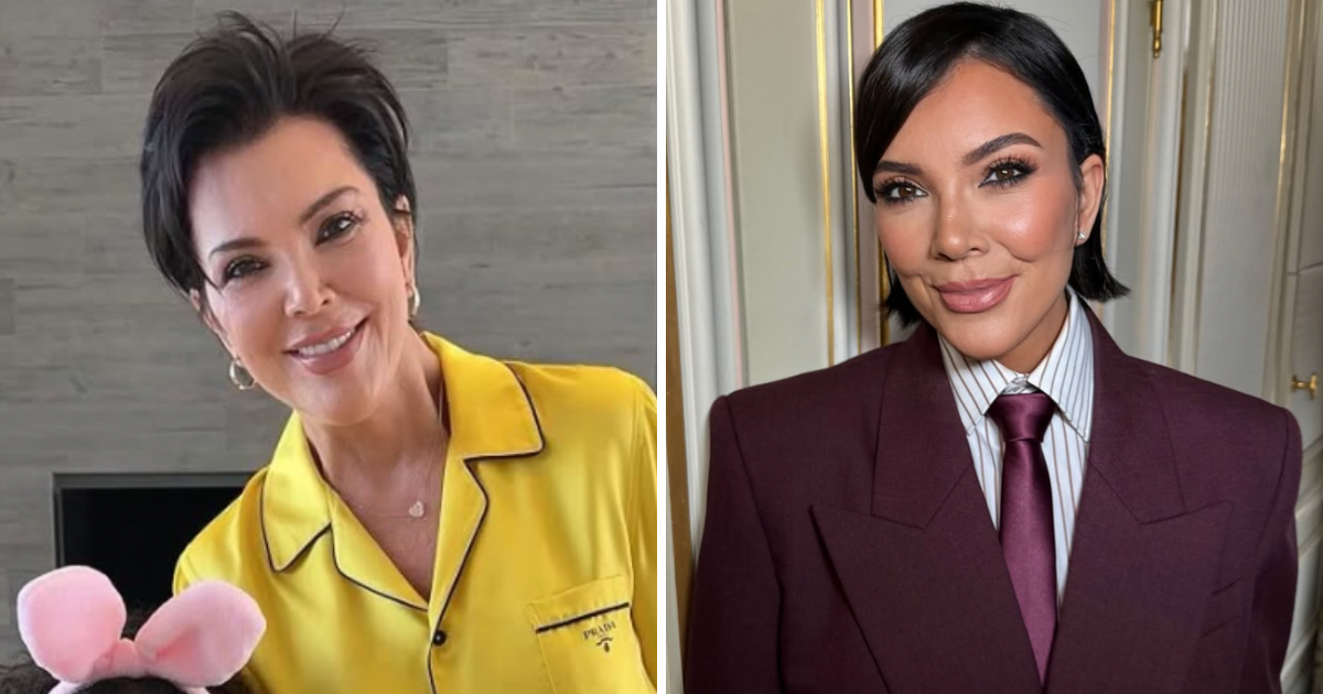 kris jenner facelift cost