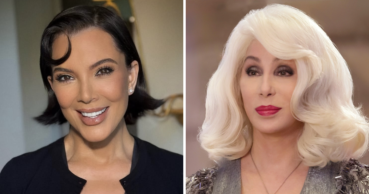 kris jenner deep plane facelift