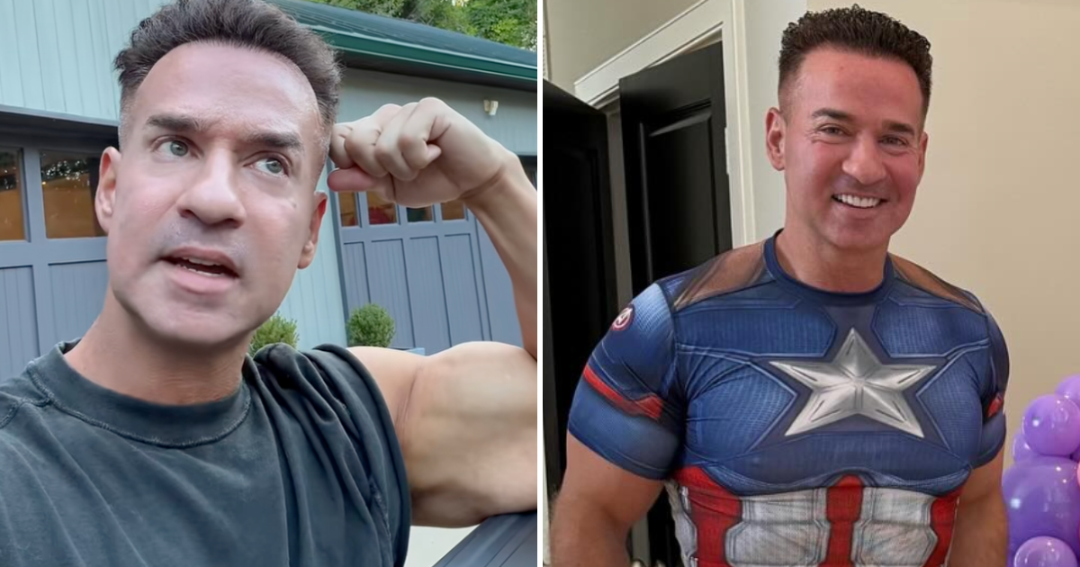 jersey shore mike face lift