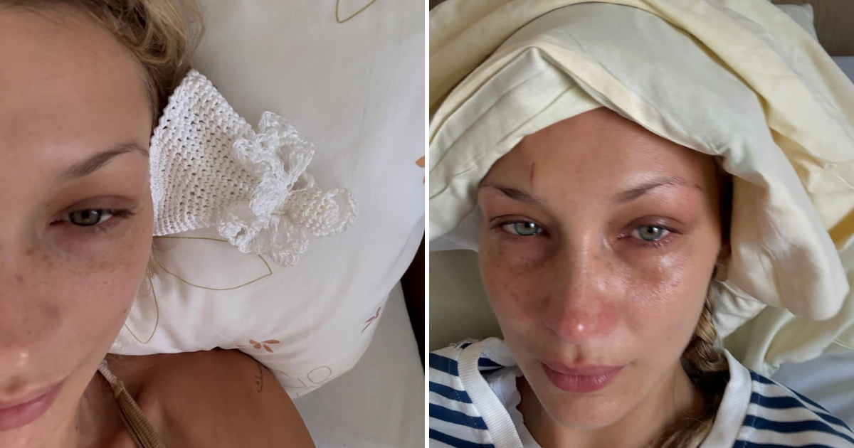 Bella Hadid update from hospital