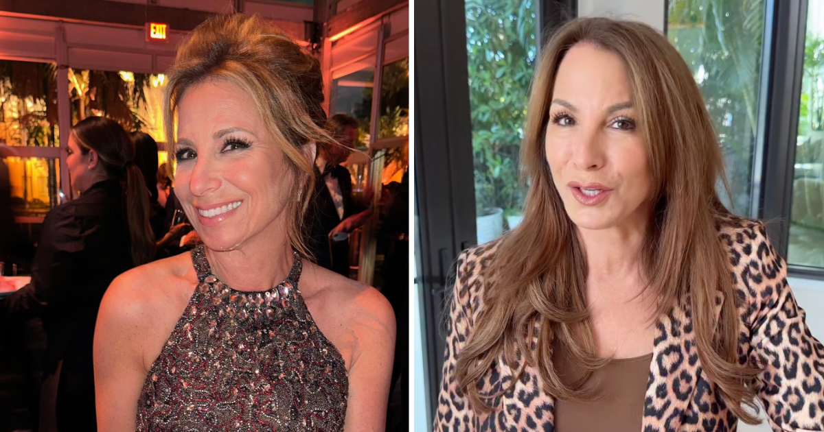jill zarin facelift