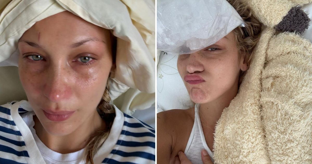Bella hadid hospital reveal
