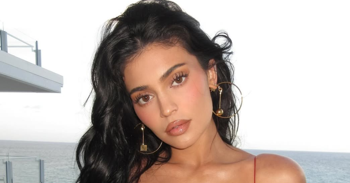 Kylie Jenner fillers