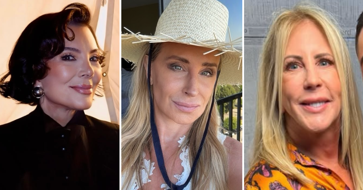 celebrity facelifts before and after