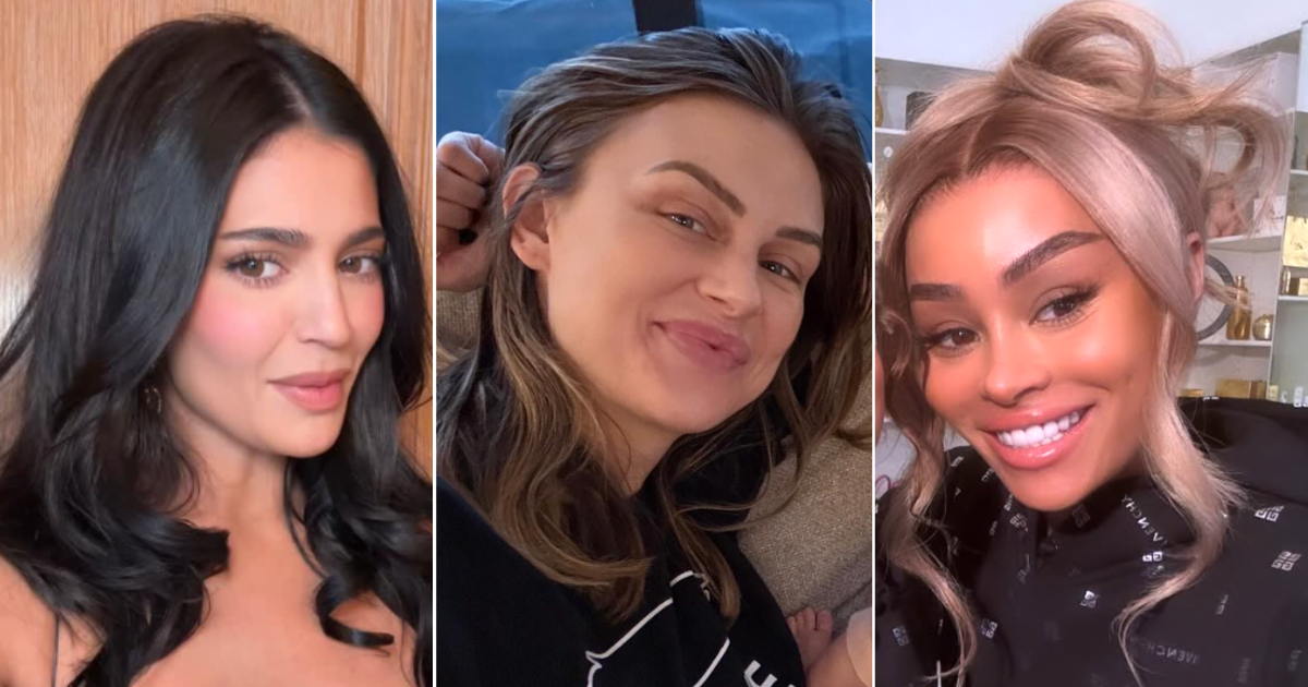 reality tv cosmetic tweak