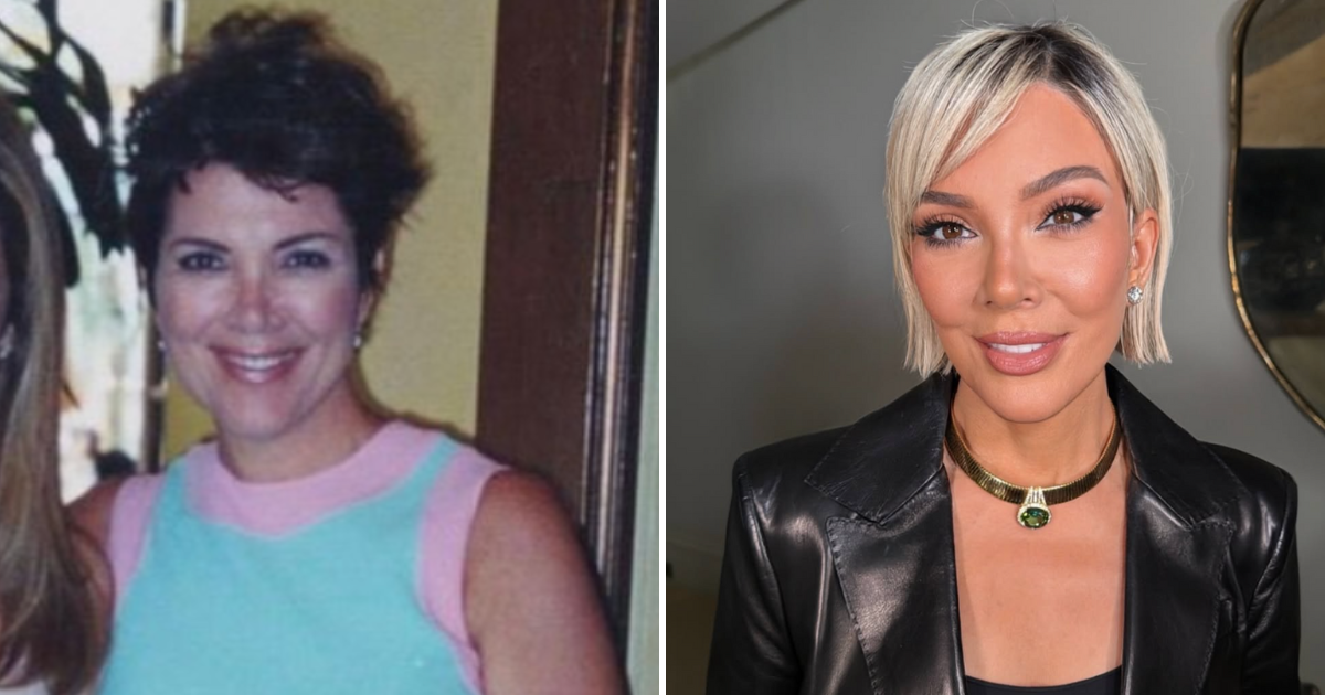 Kris Jenner all surgeries and tweaks