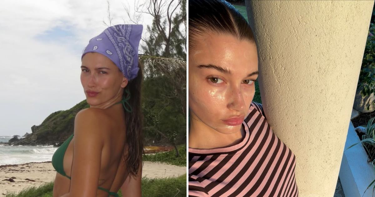 Hailey Bieber botox