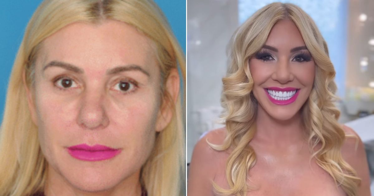 rosalyn plastic surgery Members Only Palm Beach