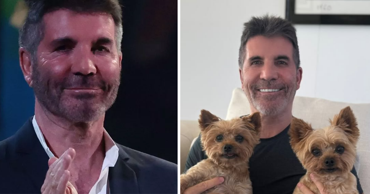 Simon Cowell plastic surgery face