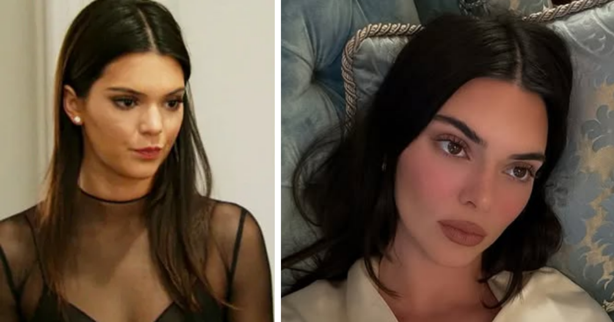 Kendall Jenner plastic surgery