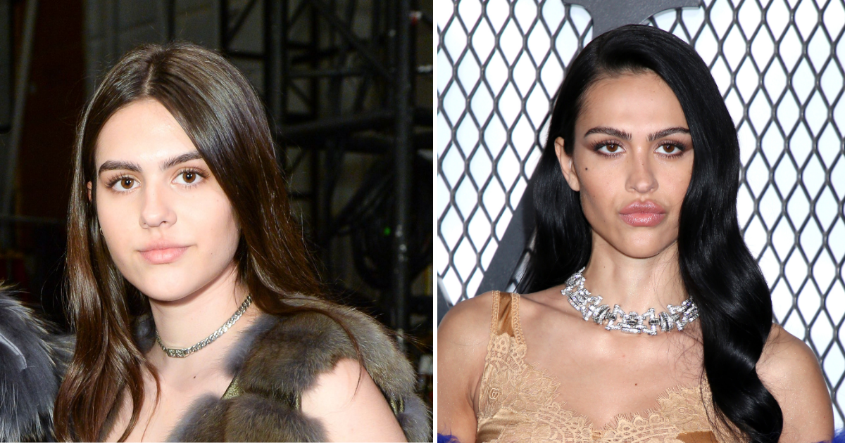 Amelia Gray Hamlin plastic surgery