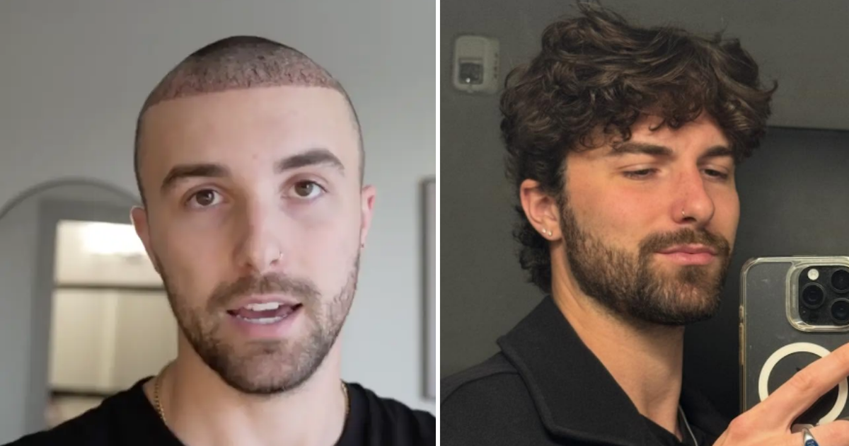 Zac Woodworth Love Island All Stars