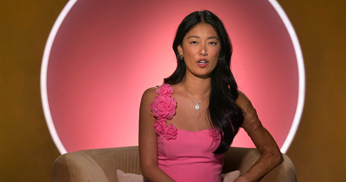 Emma Betsinger Love Is Blind scarred arm what happened