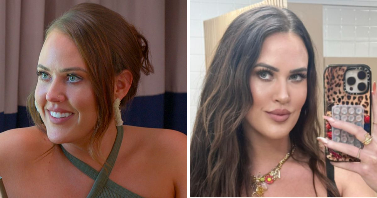 Love Is Blind surgery transformations