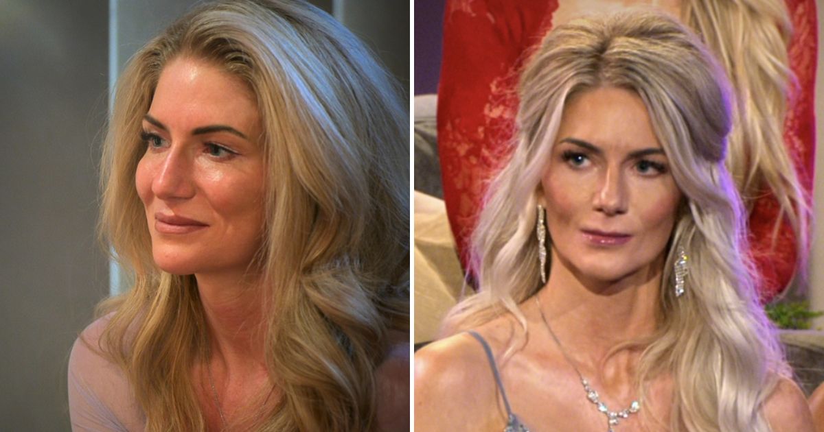 amber plastic surgery love is blind