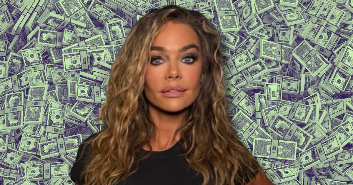 Denise Richards facelift