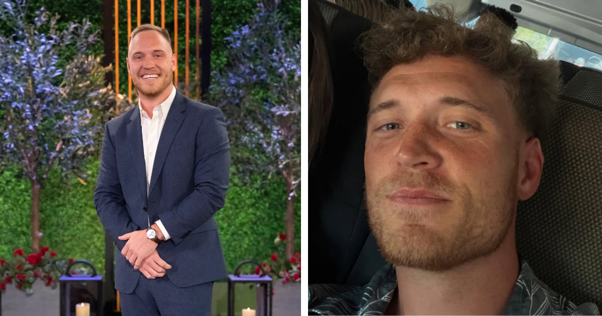 Jimmy Presnell plastic surgery