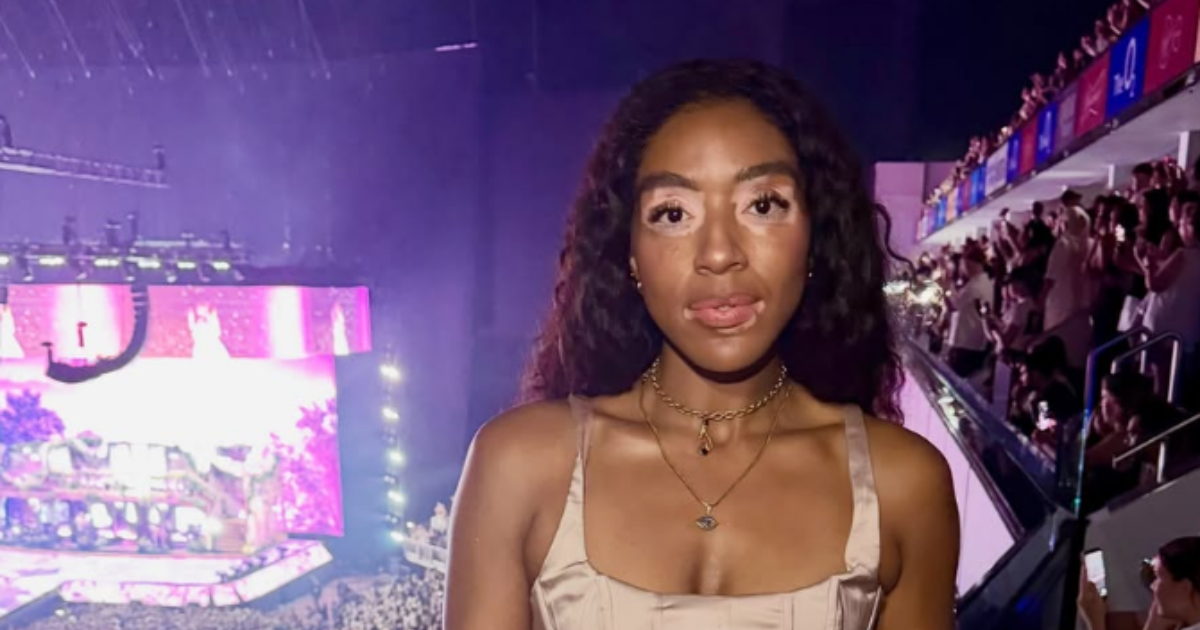 Yasmin vitiligo Love Is Blind UK