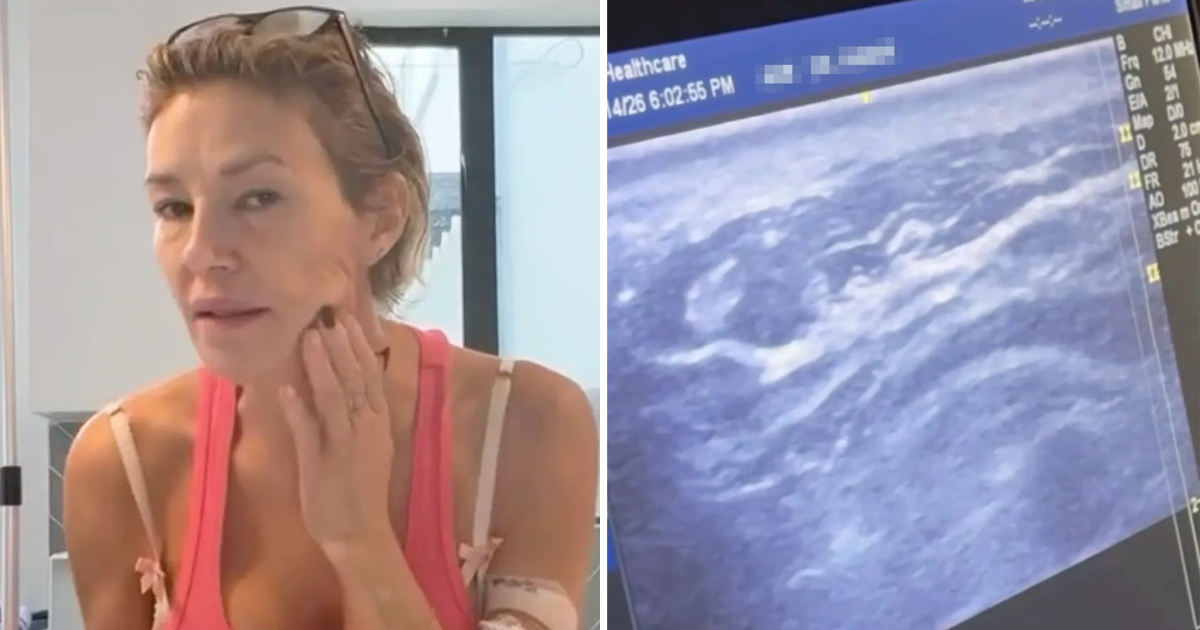 Former Real Housewives of Beverly Hills star Brandi Glanville has opened up about her health issues, claiming her face parasite is back.