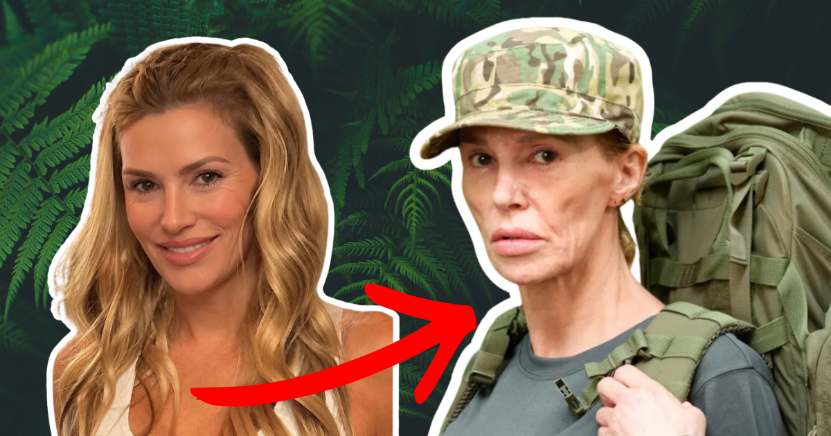 Brandi Glanville’s Special Forces appearance follows years of facial health battle
