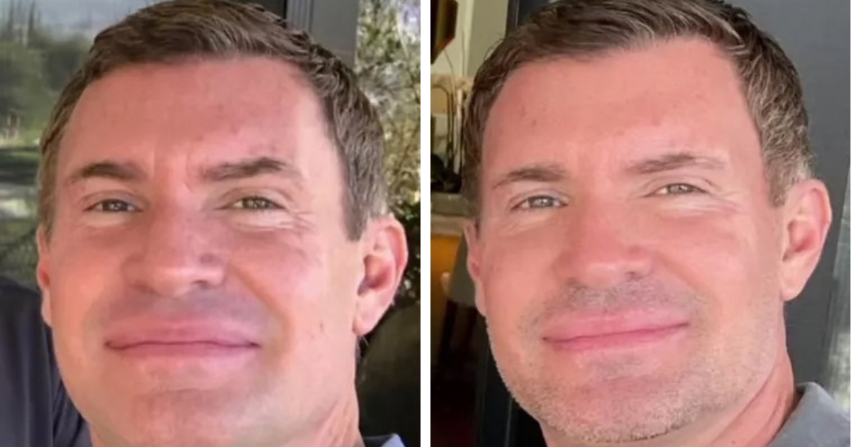 Jeff Lewis opens up about his plastic surgery history, including an eyelid procedure